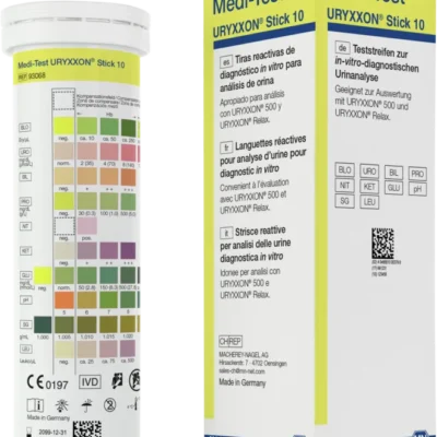 Analisi delle urine